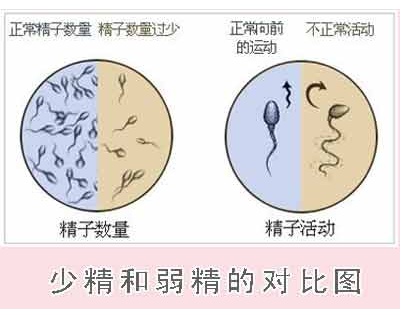 弱精少精死精戒烟三个月有改善吗,少精弱精是怎么引起的