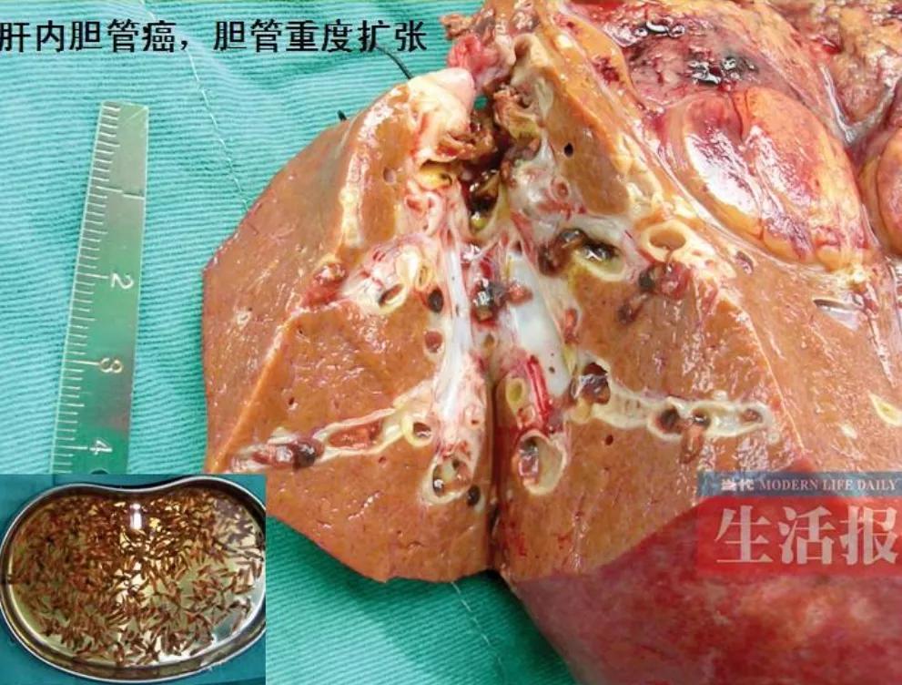 淡水未煮熟生鱼片能吃吗？