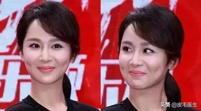 笑出法令纹!还能肆无忌惮地笑吗?正常笑!但改掉这5个习惯