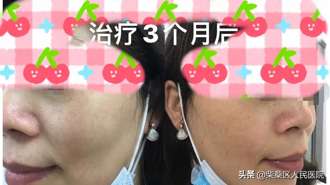 激光医疗美容机构,九江柴桑区专业祛斑祛痘店