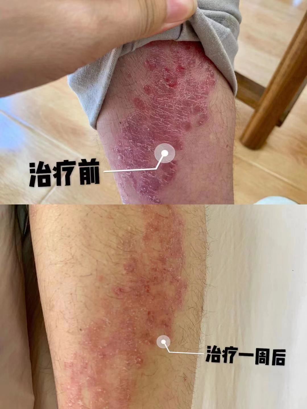 固始县人民医院疼痛科,光山县人民医院疼痛科