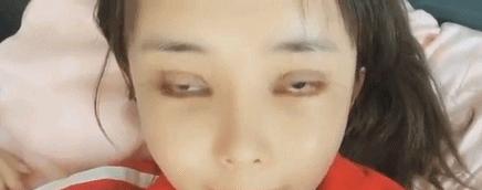 医美最火的项目,哪些皮肤类医美项目不建议做