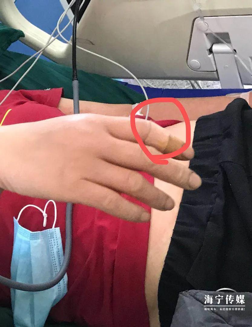 十大毒虫咬人后果,十大毒虫咬人了怎么办