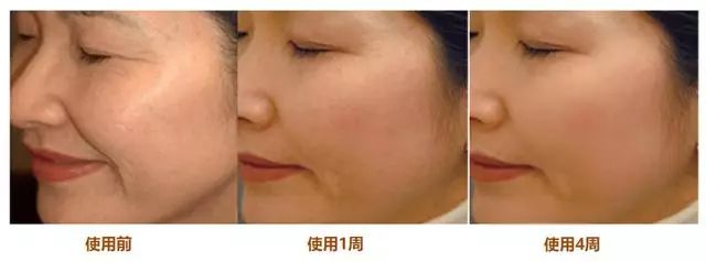 香港明星代言补水去黄提亮面膜,各路明星推荐的面膜怎么样