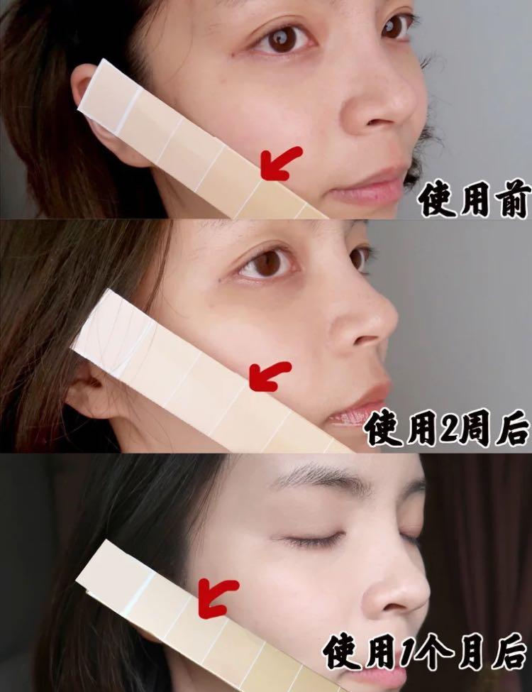 美白针对身体有危害,美白针的危害到底有多大