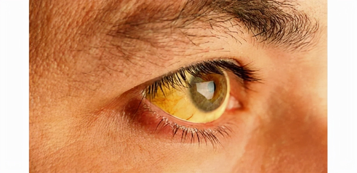 中医看肝不好引起的皮肤痒,皮肤痒肝不好