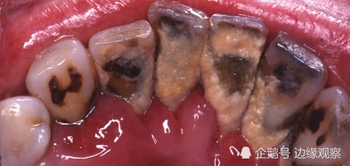 韩国烟淡绿色包装,韩国香烟包装都带效果图吗