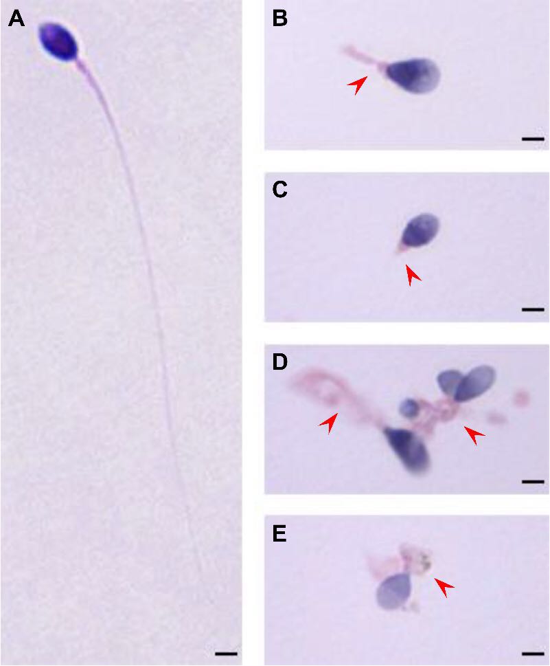 科学家发现性染色体的过程,上海治疗弱精的专家
