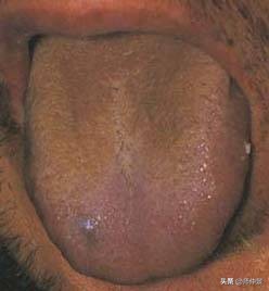 最实用的舌诊图六大舌象,舌诊深入学习书