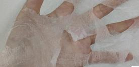 脸上长闭口怎么办教你正确去闭口,去闭口最简单的消除方法