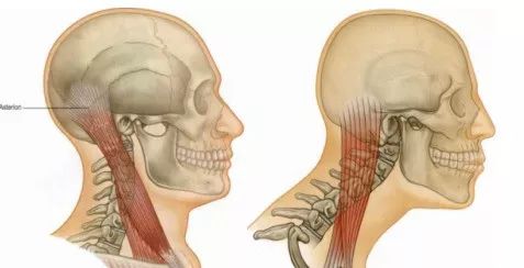 颈项疼痛与颈丛关系,颈项强痛不