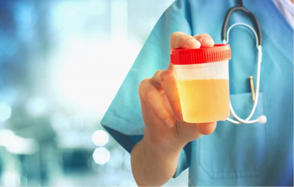 尿糖一般几个加号是糖尿病,尿糖跟糖尿病有什么区别