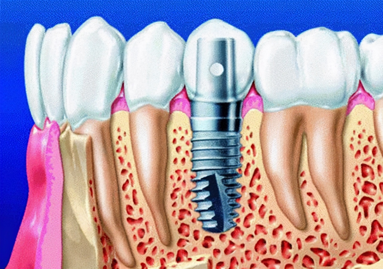 一个小众到股票软件都没有记载的板块，为何引16路顶流基金哄抢？