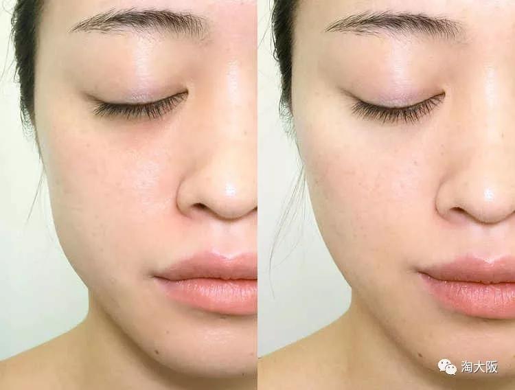 refacaxaray少女心美容仪,refa美脸仪