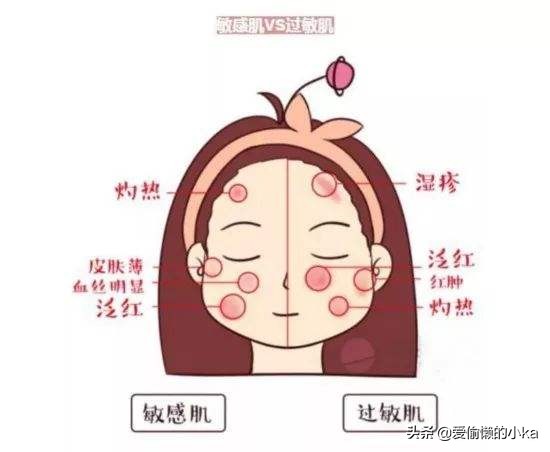 只涂了防晒午休可以戴着睡觉吗,只涂了防晒需要用卸妆油卸妆吗