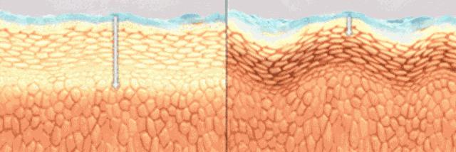 用了很多眼霜还是有黑眼圈？别怪产品太鸡肋，只能说是你没选对