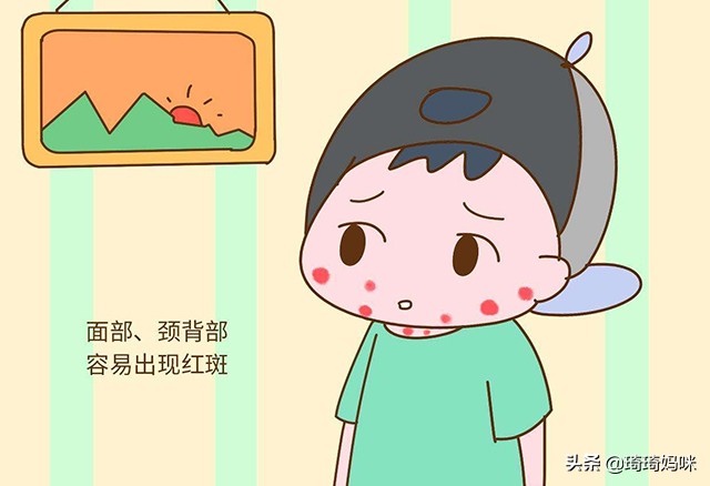 宝宝身体痒是什么原因引起的,宝宝全身发痒是怎么回事