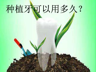 种植牙和烤瓷牙究竟有哪些区别？为什么都说种植牙好？