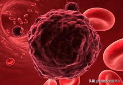 肿瘤标志物筛查多少钱,肺肿瘤标志物有哪几项