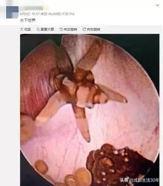 华西医院牛主任,最牛泌尿科医生排名