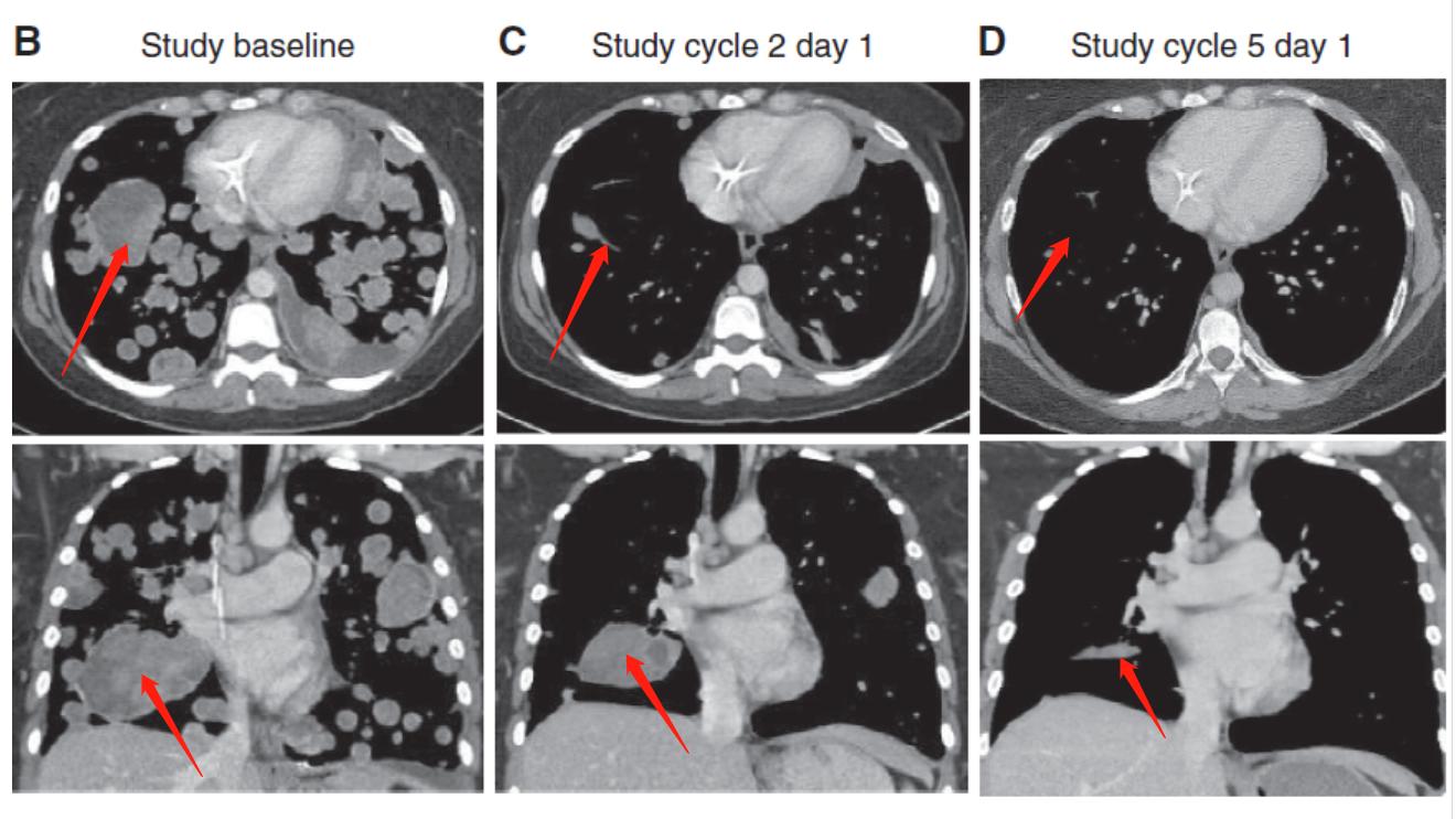 国际最新针对肿瘤的治疗,美国fda新药申请的途径