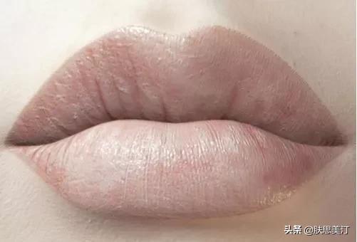 击退黑唇就靠这几招