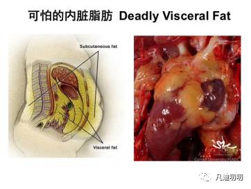 腰围是骨骼决定的,腰围的决定因素