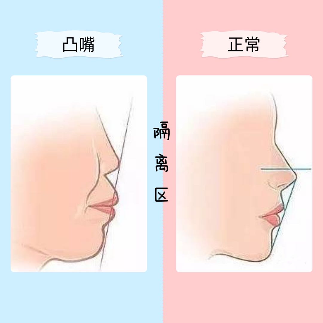 还不到30岁的郑爽，法令纹就这么明显了？*力暴**按摩，她的脸没事吧