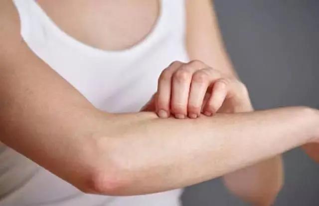 鸡皮肤严重的人图片,很严重的鸡皮肤能治好吗