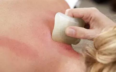 颈椎包夺命包富贵包,颈椎富贵包怎么解决