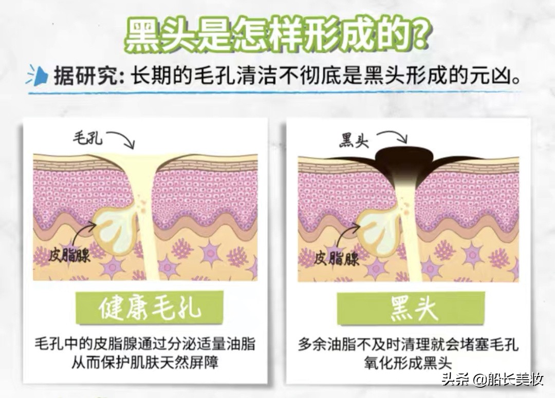 不用一次白泥,你永远不知道脸上有多脏