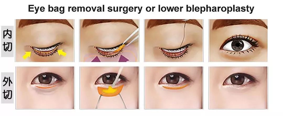 眼部常见问题有哪些,常见眼部问题