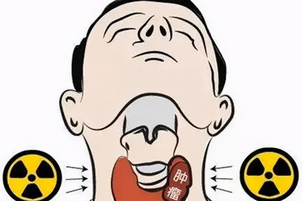 这几种癌不可怕早期可以完全治愈,为什么现在癌年轻化