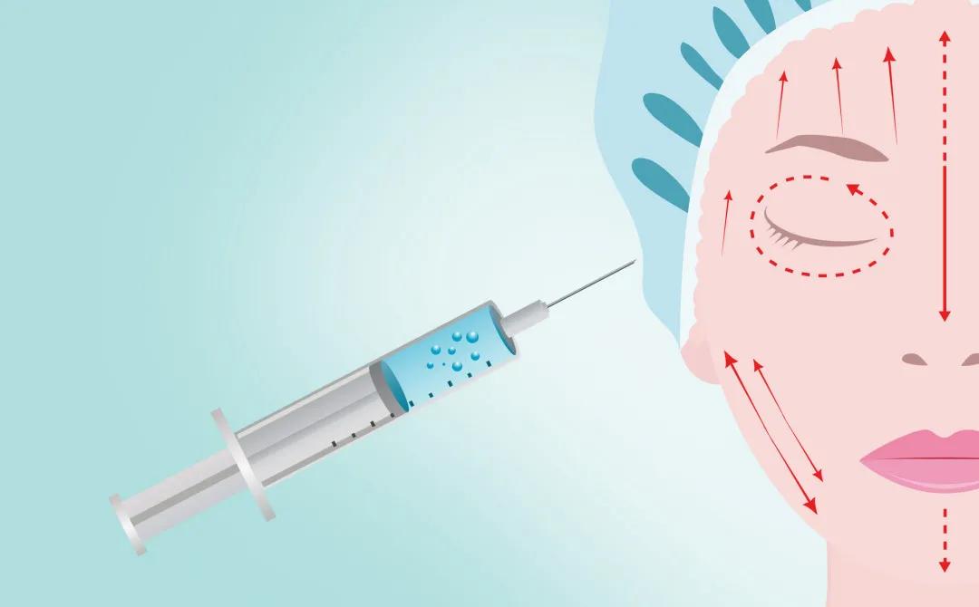 青岛非法售卖肉毒素,青岛非法走私肉毒素