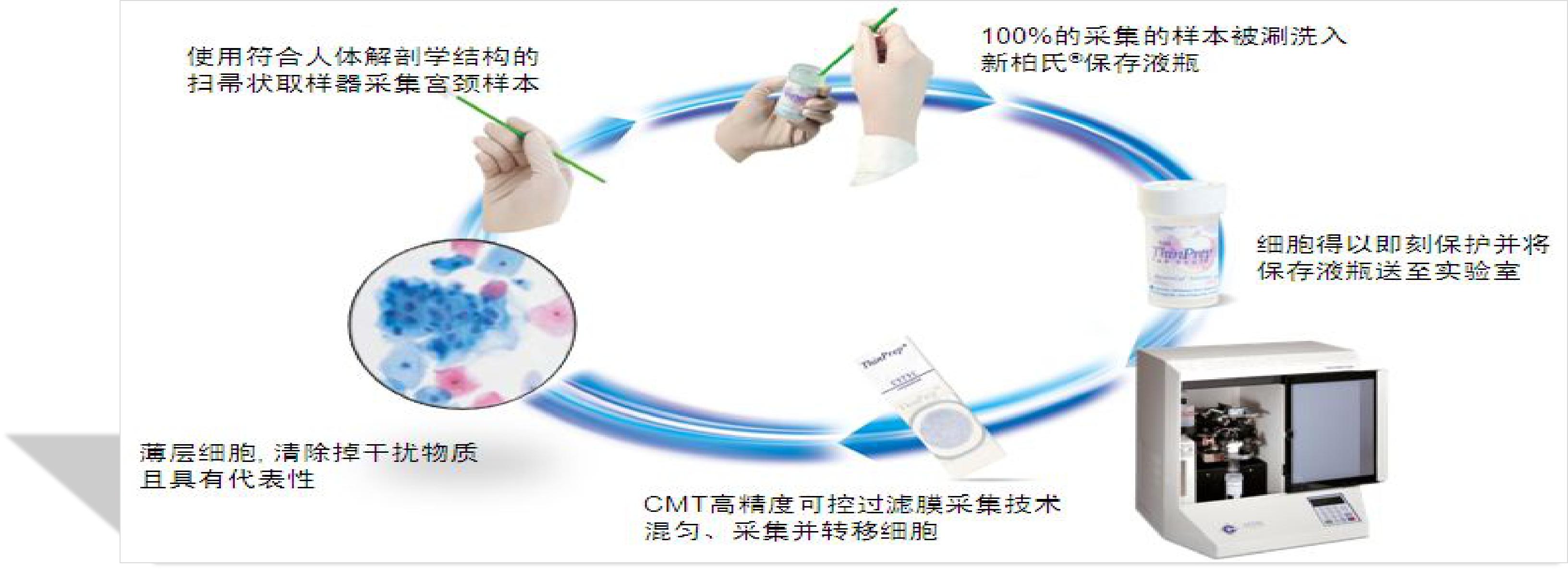 宫颈病变的诊断与治疗科普,宫颈低度病变如何治疗