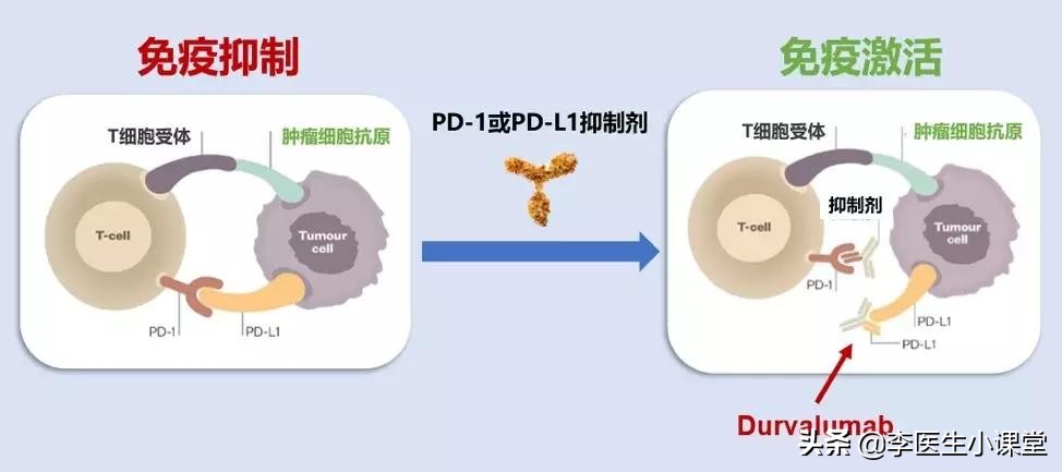什么是免疫治癌,什么是癌症免疫治疗和生物治疗
