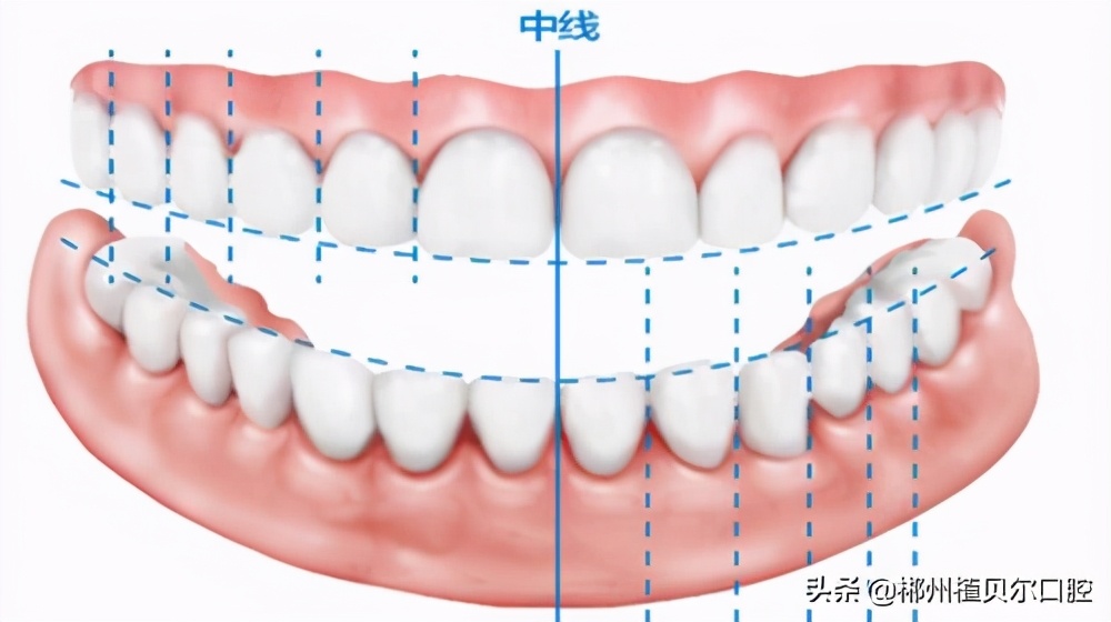 干货牙齿矫正的几个疑问为你解答,牙齿矫正过来人教你怎么避坑