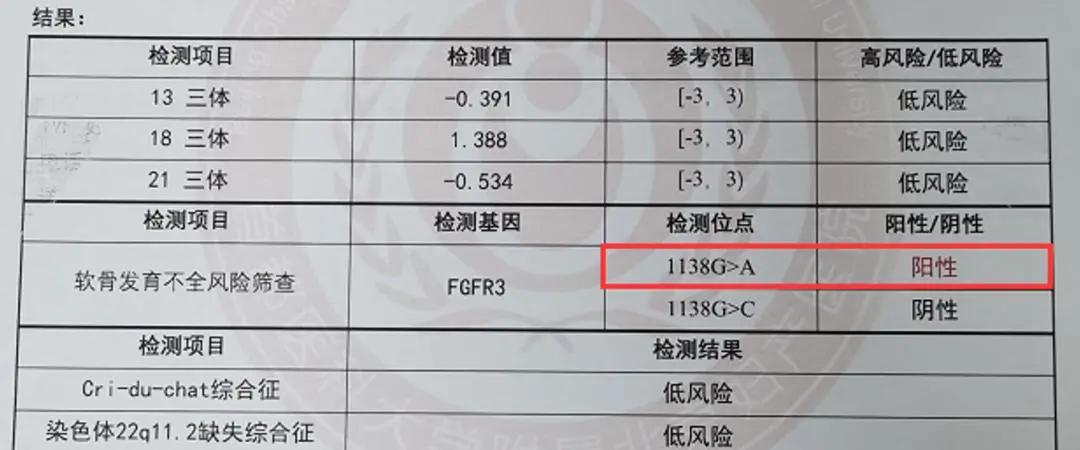 产妇b超显示头部偏大,孕期单纯股骨偏小