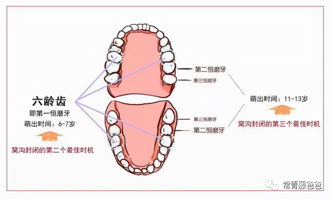 6-12岁儿童换牙的顺序图片,6-12岁换牙的顺序
