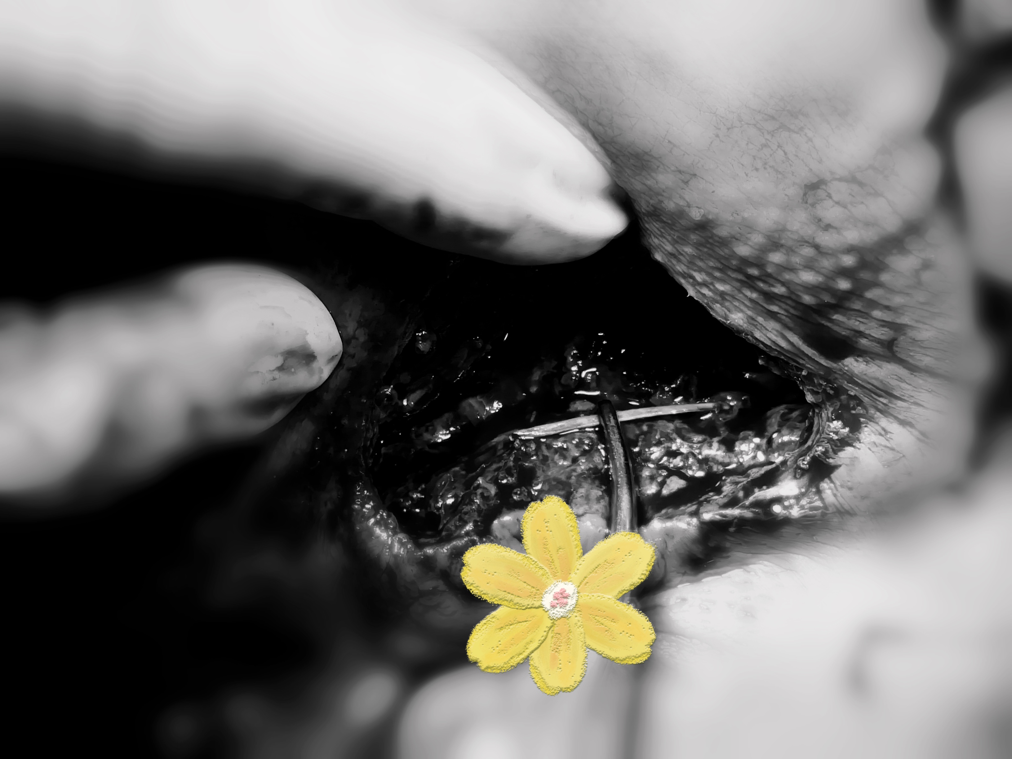 屁屁痛很像肌肉拉伤,屁屁痛肚子痛是什么原因