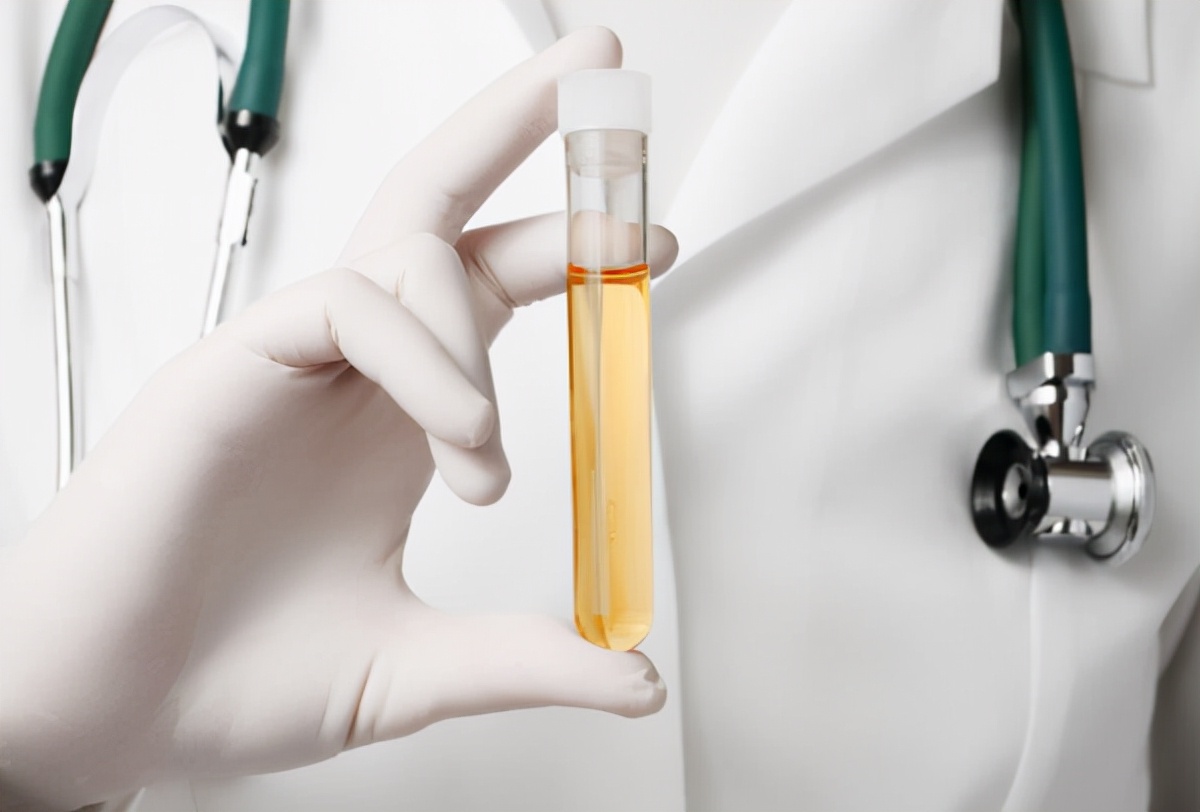 糖尿病肾病降肌酐最有效的药,糖尿病肾病降肌酐中草药方