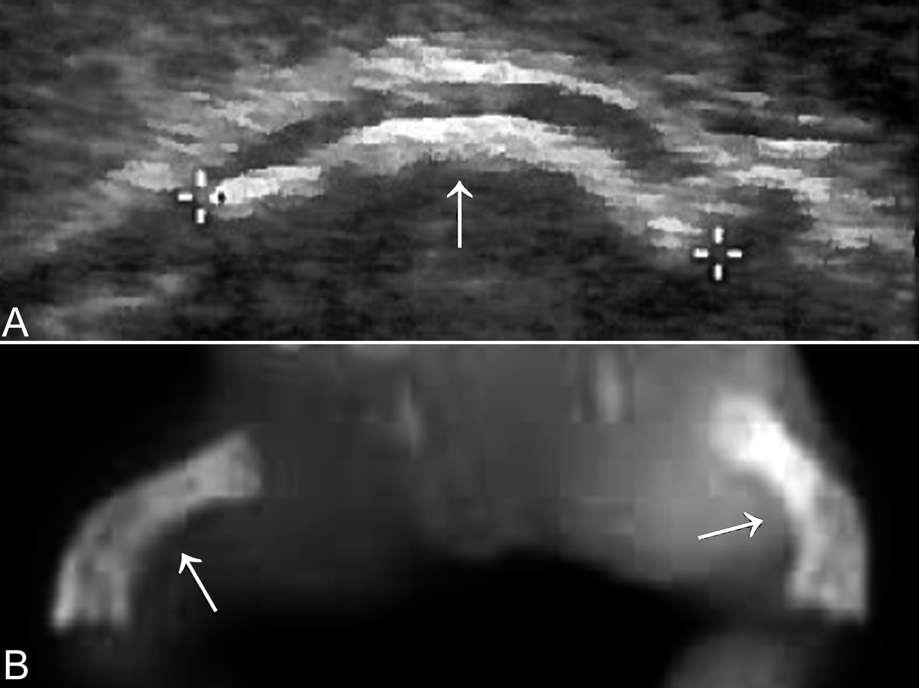 明明白白做ct检查,明明白白做超声