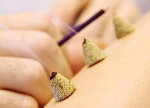 使用艾灸暖宫后月经变少,做艾灸会导致月经推迟吗