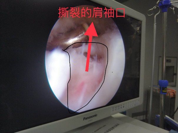 关注颈肩腰痛,关注颈肩腰腿疼痛