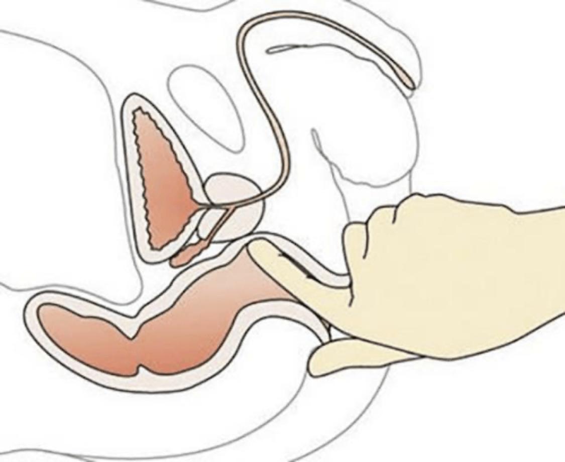 大“菊”为重，别再因为恐惧，错失这些疾病的确诊机会