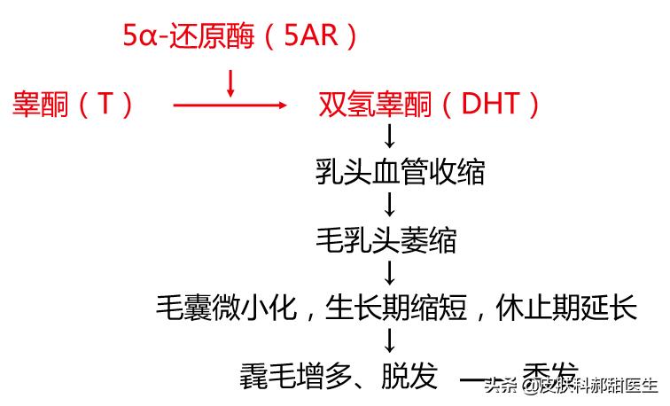 雄激素性脱发的中医认识,雄激素性脱发怎么诊断