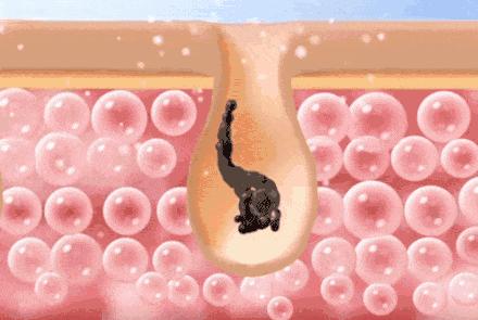 原来她们都在偷偷用这个！这个秘密只有皮肤水嫩柔滑的妹子才知道