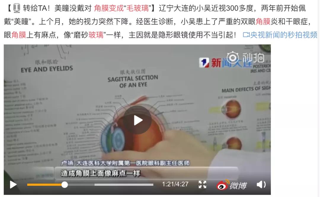 女子眼睛干涩发痒一查竟长满了虫,眼睛生了螨虫怎么治疗