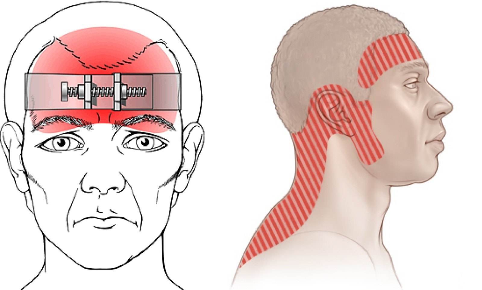 最近有没有人出现头特别疼,感觉脑壳痛的不是自己的了