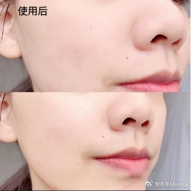 秋季面膜冰箱敷,秋季自制补水面膜